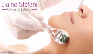 Sessão de microagulhamento dermaroller com reposição de vitaminas com máscara de ácido hialurônico na Elaine Stefani Clínica de Estética em até 10x no cartão*
